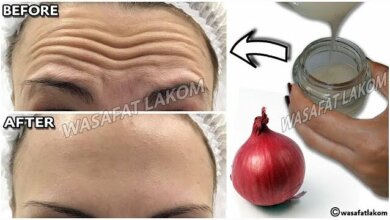 1 Onion Nature’s Powerful Anti-Wrinkle Remedy