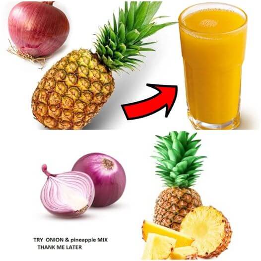 Natural Remedies for Bronchitis Pineapple and Lemon