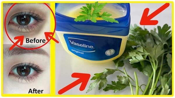 Rejuvenate Your Skin Naturally with Parsley and Vaseline