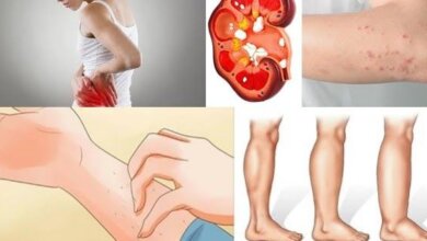 Signs Your Kidneys Might Be in Danger